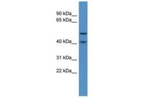 Image no. 1 for anti-Fukutin Related Protein (FKRP) (C-Term) antibody (ABIN6746249) (FKRP 抗体  (C-Term))