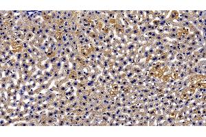 Immunohistochemistry (IHC) image for anti-Orosomucoid 2 (ORM2) (AA 19-207) antibody (ABIN7436921)