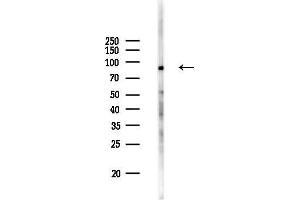 anti-Heat Shock 70kDa Protein 4-Like (HSPA4L) (C-Term) antibody