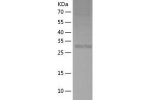 Western Blotting (WB) image for Leucine Zipper Transcription Factor-Like 1 (LZTFL1) (AA 1-299) protein (His tag) (ABIN7123752) (LZTFL1 Protein (AA 1-299) (His tag))