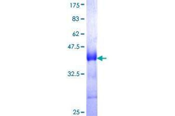 CD320 Protein (AA 97-196) (GST tag)