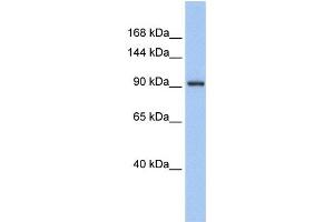 Western Blotting (WB) image for anti-Zinc Finger Protein 295 (ZNF295) antibody (ABIN2457974) (ZNF295 抗体)