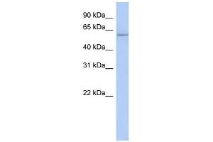 Copine IV antibody used at 1 ug/ml to detect target protein. (Copine IV 抗体  (N-Term))