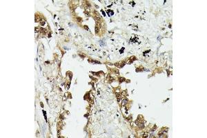 Immunohistochemistry (IHC) image for anti-Heat Shock 70kDa Protein 1A (HSPA1A) (AA 500-600) antibody (ABIN6142038)