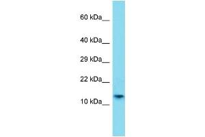 Host: Rabbit Target Name: H2AFB1 Sample Type: A549 Whole Cell lysates Antibody Dilution: 1.