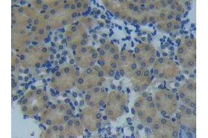 Immunohistochemistry (IHC) image for anti-Matrix Metallopeptidase 14 (Membrane-inserted) (MMP14) (AA 121-487) antibody (ABIN7434626)