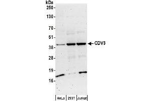 anti-CDV3 Homolog (CDV3) (AA 208-258) antibody