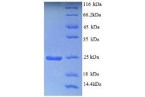 SDS-PAGE (SDS) image for Aldehyde Oxidase 1 (AOX1) (AA 236-421), (PCMH-type domain) protein (His tag) (ABIN5709049) (AOX1 Protein (AA 236-421, PCMH-type domain) (His tag))