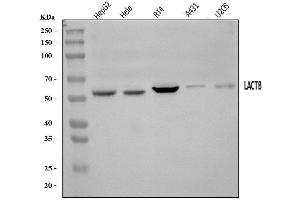 Western blot analysis of LACTB using anti-LACTB antibody (ABIN7600047).