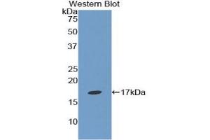 Detection of Recombinant EPN1, Human using Polyclonal Antibody to Epsin 1 (EPN1) (Epsin 1 抗体  (AA 279-437))