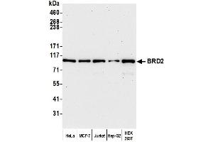 Western Blotting (WB) image for anti-Bromodomain Containing 2 (BRD2) (AA 675-725) antibody (ABIN7453879)