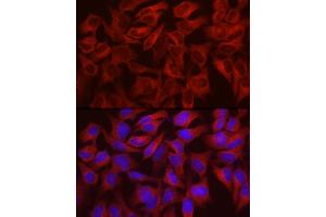 Immunofluorescence analysis of HeLa cells using WISP2 Rabbit pAb (ABIN6128928, ABIN6150226, ABIN6150228 and ABIN6216206) at dilution of 1:100 (40x lens). (WISP2 抗体  (AA 151-250))