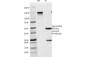 SDS-PAGE Analysis Purified gp100 / Melanosome Mouse Monoclonal Antibody (NKI-beteb). (Melanoma gp100 抗体)