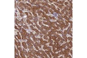 Immunohistochemical staining of human liver with SCD5 polyclonal antibody  shows strong cytoplasmic positivity in hepatocytes.