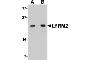 Western Blotting (WB) image for anti-LYR Motif Containing 2 (LYRM2) (C-Term) antibody (ABIN1030499) (LYRM2 抗体  (C-Term))