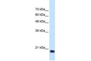 Image no. 2 for anti-Signal Sequence Receptor, beta (Translocon-Associated Protein Beta) (SSR2) (N-Term) antibody (ABIN205080) (SSR2 抗体  (N-Term))