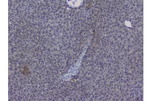 IHC analysis of NRF1 using anti-NRF1 antibody (ABIN6719347).