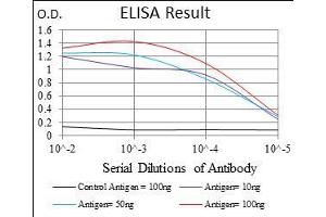 Black line: Control Antigen (100 ng), Purple line: Antigen(10 ng), Blue line: Antigen (50 ng), Red line: Antigen (100 ng), (TWIST1 抗体  (AA 9-74))