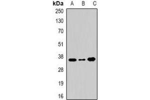 Western blot analysis of WDR5 expression in 22RV1 (A), BT474 (B), Hela (C) whole cell lysates. (WDR5 抗体)
