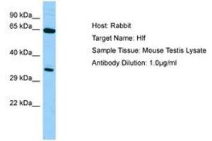 Image no. 1 for anti-Hepatic Leukemia Factor (HLF) (N-Term) antibody (ABIN6749814) (HLF 抗体  (N-Term))