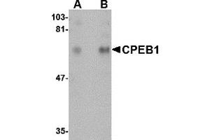 Western Blotting (WB) image for anti-Cytoplasmic Polyadenylation Element Binding Protein 1 (CPEB1) (N-Term) antibody (ABIN1031326) (CPEB1 抗体  (N-Term))