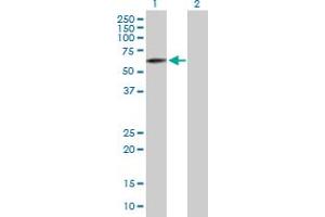 Western Blot analysis of FAM82C expression in transfected 293T cell line by FAM82C MaxPab polyclonal antibody. (RMDN3 抗体  (AA 1-470))