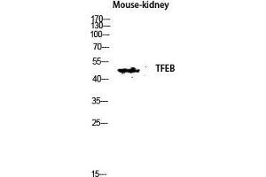 Western Blot (WB) analysis of Mouse Kidney lysis using TFEB antibody. (TFEB 抗体  (N-Term))
