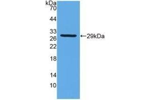 Detection of Recombinant GSTt2, Rat using Polyclonal Antibody to Glutathione S Transferase Theta 2 (GSTt2) (GSTT2 抗体  (AA 16-242))