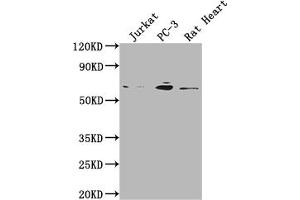 Western Blot Positive WB detected in: Jurkat whole cell lysate, PC-3 whole cell lysate, Rat Heart tissue All lanes: E2F1 antibody at 1:2000 Secondary Goat polyclonal to rabbit IgG at 1/50000 dilution Predicted band size: 47 kDa Observed band size: 60 kDa (Recombinant E2F1 抗体)