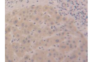 DAB staining on IHC-P; Samples: Human Liver Tissue (DDO 抗体  (AA 117-199))