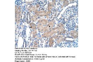 Rabbit Anti-SLA/LP Antibody  Paraffin Embedded Tissue: Human Kidney Cellular Data: Epithelial cells of renal tubule Antibody Concentration: 4. (SLA 抗体  (N-Term))
