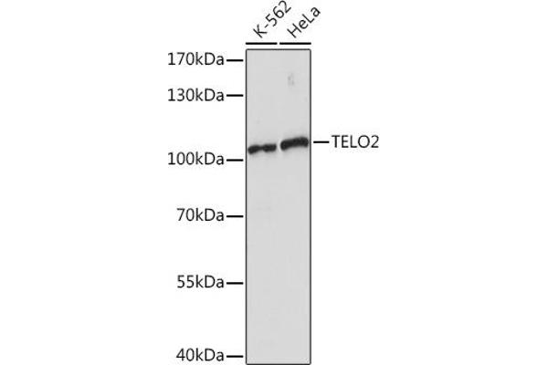TELO2 抗体  (AA 450-550)