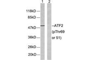 Western blot analysis of extracts from LOVO cells, using ATF2 (Phospho-Thr69 or 51) Antibody. (ATF2 抗体  (pSer69))