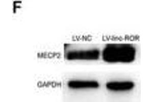 linc-ROR promoted cell proliferation, migration, and invasion of breast cancer through linc-ROR/miR-194-3p/MECP2 regulatory axis. (MECP2 抗体  (AA 1-100))