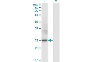 Western Blot analysis of FNDC4 expression in transfected 293T cell line by FNDC4 monoclonal antibody (M01), clone 7F9. (FNDC4 抗体  (AA 45-154))
