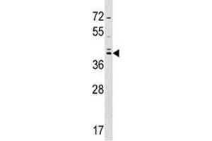 SOX7 antibody western blot analysis in HepG2 lysate. (SOX7 抗体  (AA 310-339))