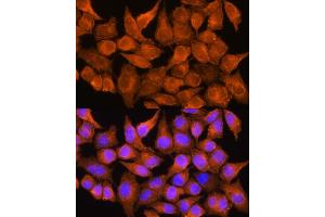 Immunofluorescence analysis of HeLa cells using  Rabbit pAb (ABIN1678678, ABIN3017841, ABIN3017842 and ABIN6220287) at dilution of 1:100.