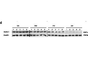 Identification of RUNX1 as an apoptosis transcription factor and an independent prognostic factor in NB tissue and cell lines. (RUNX1 抗体  (AA 221-480))