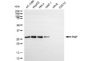 anti-Purine Nucleoside Phosphorylase (PNP) antibody