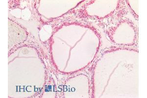 ABIN6391411 (5µg/ml) staining of paraffin embedded Human Thyroid. (Notch1 抗体  (AA 171-182))