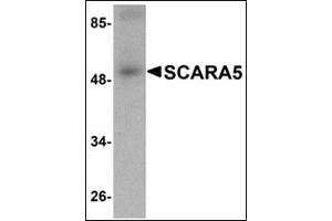 Western blot analysis of SCARA5 in human liver tissue lysate with SCARA5 antibody at 1 μg/ml. (SCARA5 抗体  (C-Term))