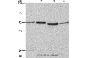 Western blot analysis of A375 and 231 cell, 293T cell and human hepatocellular carcinoma tissue , using SYN1 Polyclonal Antibody at dilution of 1:550 (SYN1 抗体)