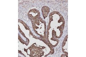 Immunohistochemical analysis of C on paraffin-embedded Human prostate tissue was performed on the Leica®BOND RXm. (LGALS3BP 抗体  (AA 383-412))