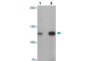 Western blot analysis of ANKRD27 in K-562 cell lysate with ANKRD27 polyclonal antibody  at (lane 1) 1 and (lane 2) 2 ug/mL. (ANKRD27 抗体  (N-Term))