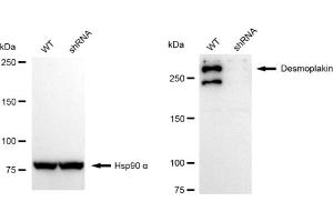 Western blotting analysis using Desmoplakin antibody (ABIN7798318).