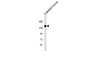 Anti-AGL Antibody (C-term) at 1:8000 dilution + human skeletal muscle lysate Lysates/proteins at 20 μg per lane. (AGL 抗体  (C-Term))