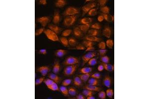 Immunofluorescence analysis of HeLa cells using A antibody (ABIN1678588, ABIN3015506, ABIN3015508 and ABIN6218562) at dilution of 1:100. (alpha 1 Adrenergic Receptor 抗体  (AA 346-475))