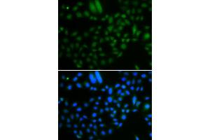 Immunofluorescence analysis of A549 cells using ALKBH8 antibody (ABIN5974297). (ALKBH8 抗体)