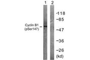 Western blot analysis of extracts from Jurkat cells treated with UV 15', using Cyclin B1 (Phospho-Ser147) Antibody. (Cyclin B1 抗体  (pSer147))