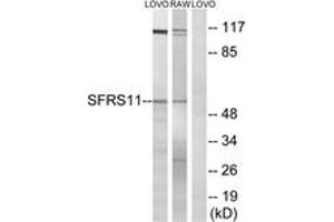 Western blot analysis of extracts from LOVO/RAW264. (SRSF11 抗体  (AA 211-260))